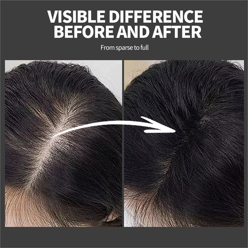 بناء الشعر والكيراتين الطبيعي ومسحوق التصفيف ومُحسِّن العناية بالشعر الكثيف وألياف إعادة النمو